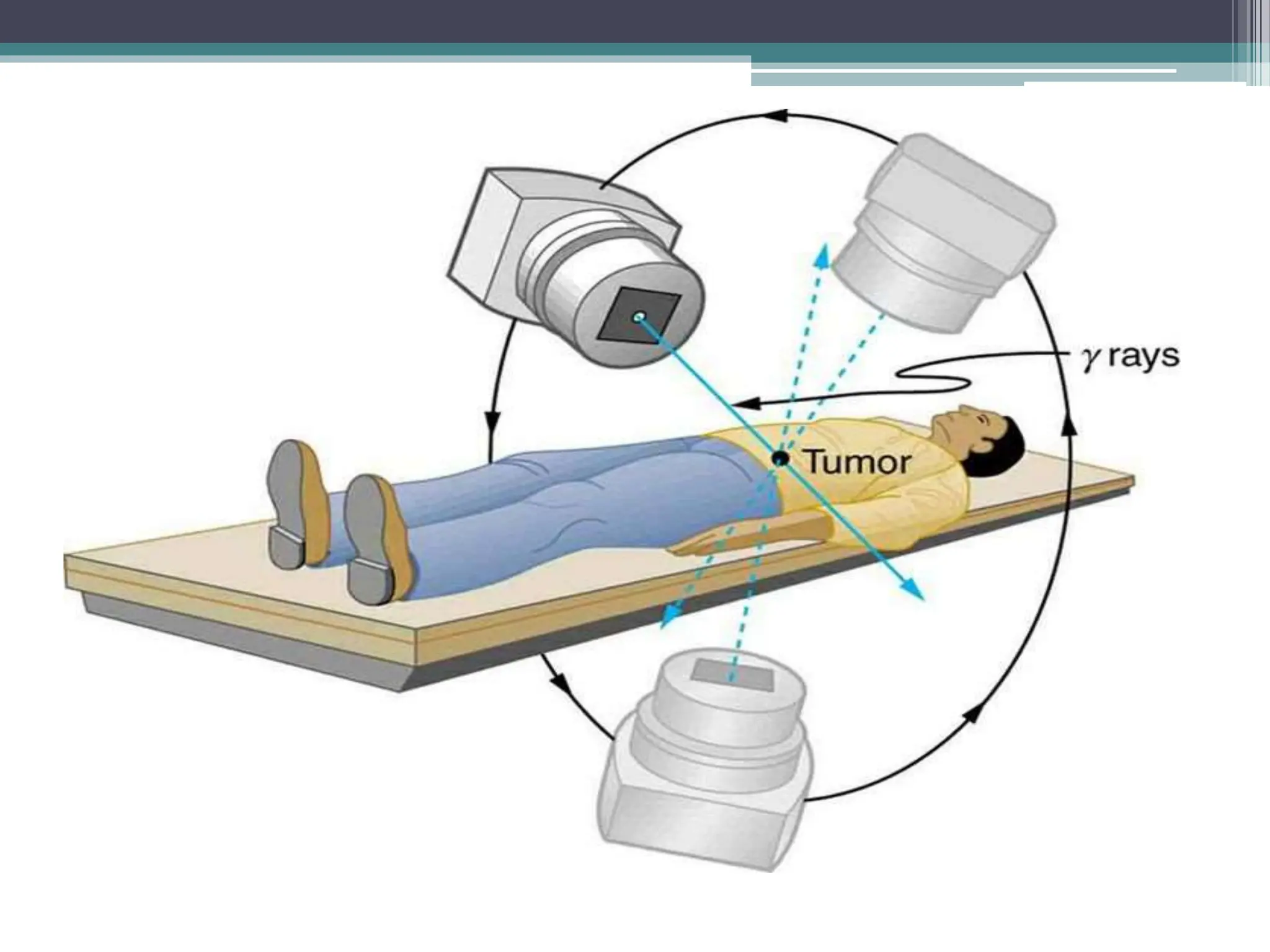 Radiotherapy ppt. Types of radiation and chronic | PPTX