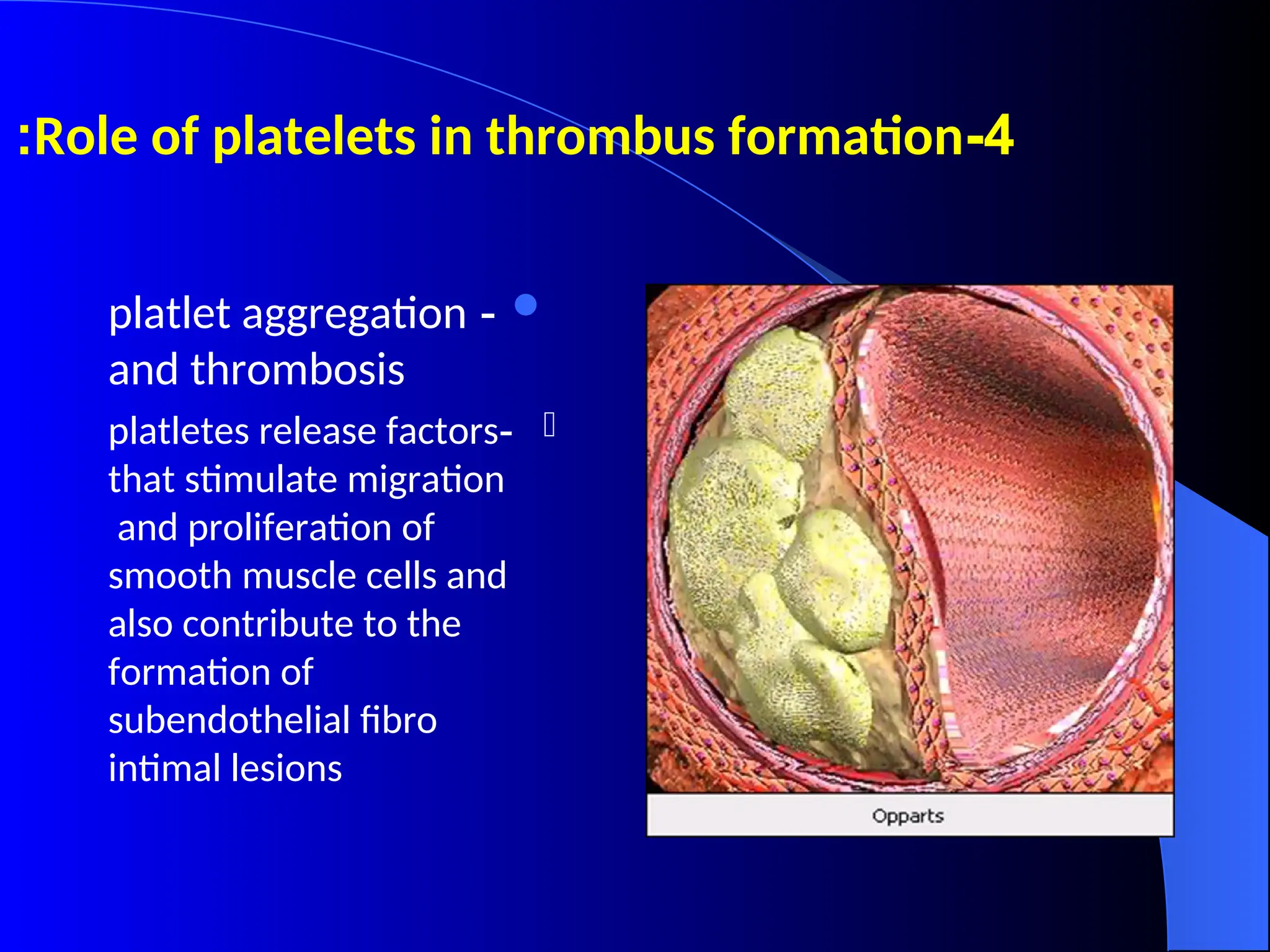 4
-
Role of platelets in thrombus formation
:

-
platlet aggregation
and thrombosis

-
platletes release factors
that stimulate migration
and proliferation of
smooth muscle cells and
also contribute to the
formation of
subendothelial fibro
intimal lesions
 