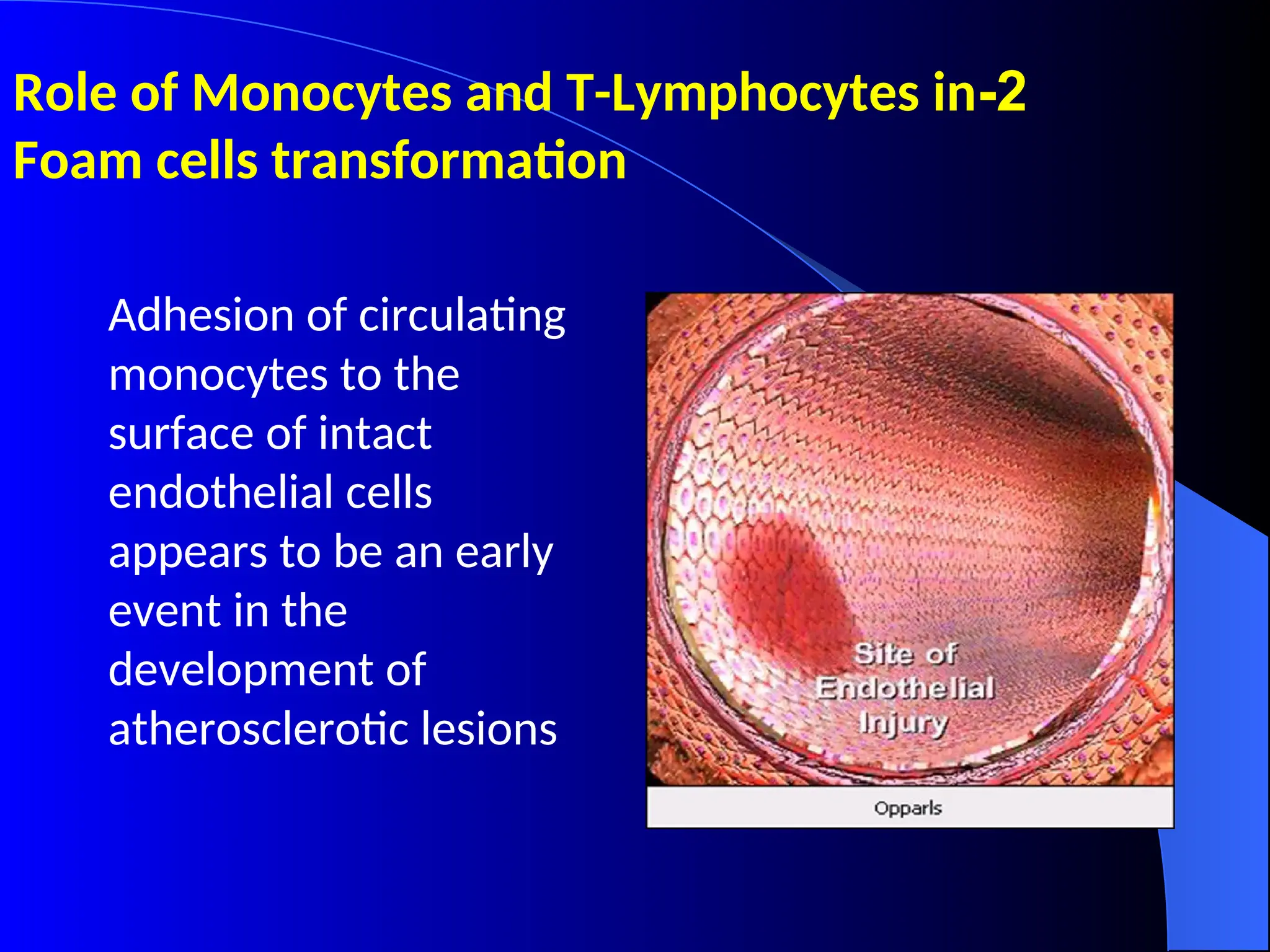 2
-
Role of Monocytes and T-Lymphocytes in
Foam cells transformation
Adhesion of circulating
monocytes to the
surface of intact
endothelial cells
appears to be an early
event in the
development of
atherosclerotic lesions
 