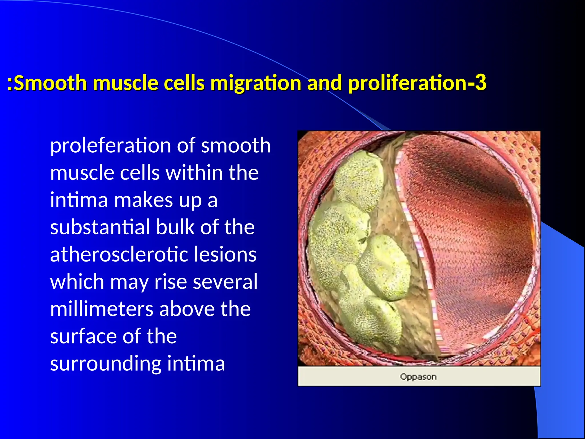 3
3
-
-
Smooth muscle cells migration and proliferation
Smooth muscle cells migration and proliferation
:
:
proleferation of smooth
muscle cells within the
intima makes up a
substantial bulk of the
atherosclerotic lesions
which may rise several
millimeters above the
surface of the
surrounding intima
 