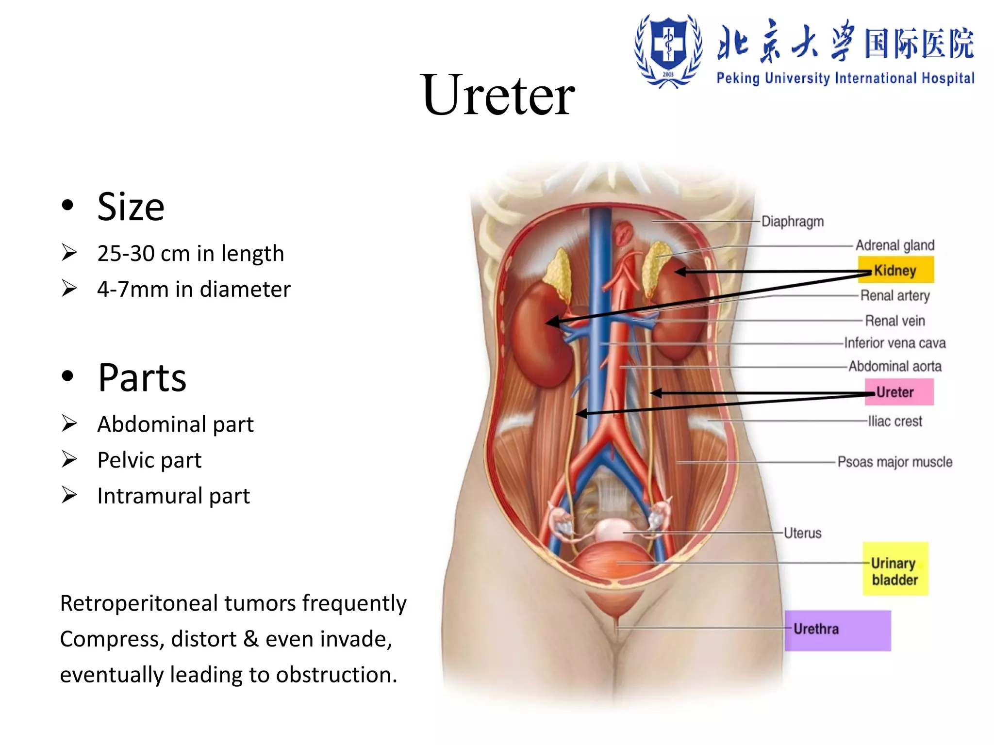 Ureter
• Size
 25-30 cm in length
 4-7mm in diameter
• Parts
 Abdominal part
 Pelvic part
 Intramural part
Retroperitoneal tumors frequently
Compress, distort & even invade,
eventually leading to obstruction.
 