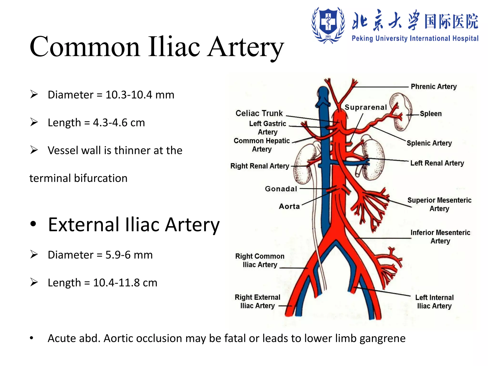 Common Iliac Artery
 Diameter = 10.3-10.4 mm
 Length = 4.3-4.6 cm
 Vessel wall is thinner at the
terminal bifurcation
• External Iliac Artery
 Diameter = 5.9-6 mm
 Length = 10.4-11.8 cm
• Acute abd. Aortic occlusion may be fatal or leads to lower limb gangrene
 
