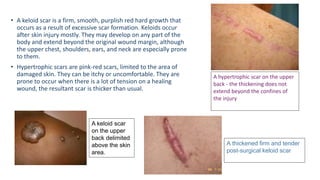 How Do Scars Develop 1 - Sutures on facial skin presentation.pptx