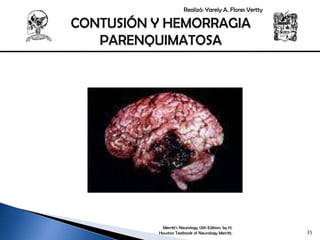 1. tce web | PPTX