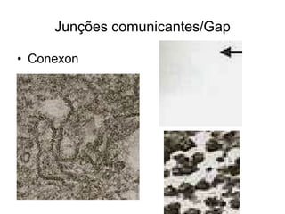 Junções comunicantes/Gap Conexon 