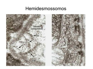 Hemidesmossomos  