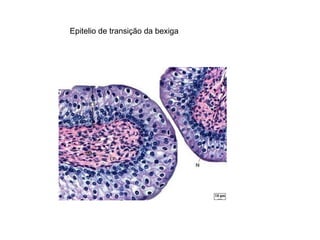 Epitelio de transição da bexiga 