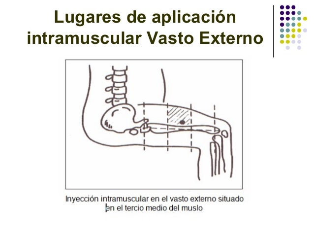 Tercio Medio De La Cara Anterolateral Externa Del Muslo Derecho