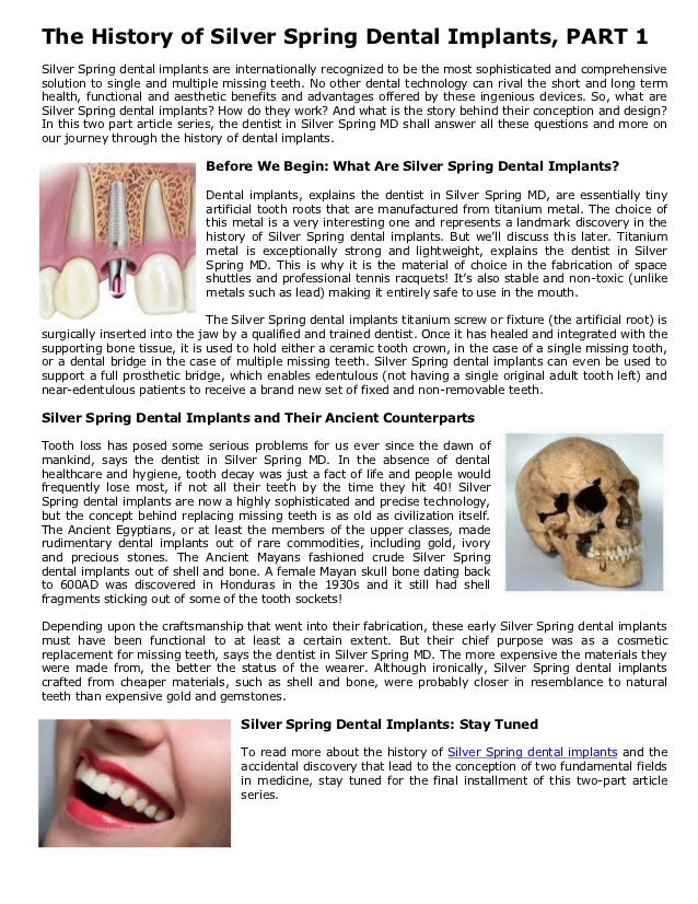 Silver Spring Dentists The History of Dental Implants, PART 2