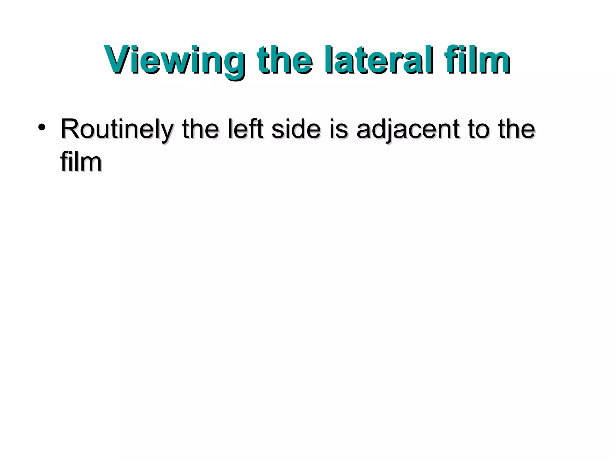 Viewing the lateral film
• Routinely the left side is adjacent to the
  film
 