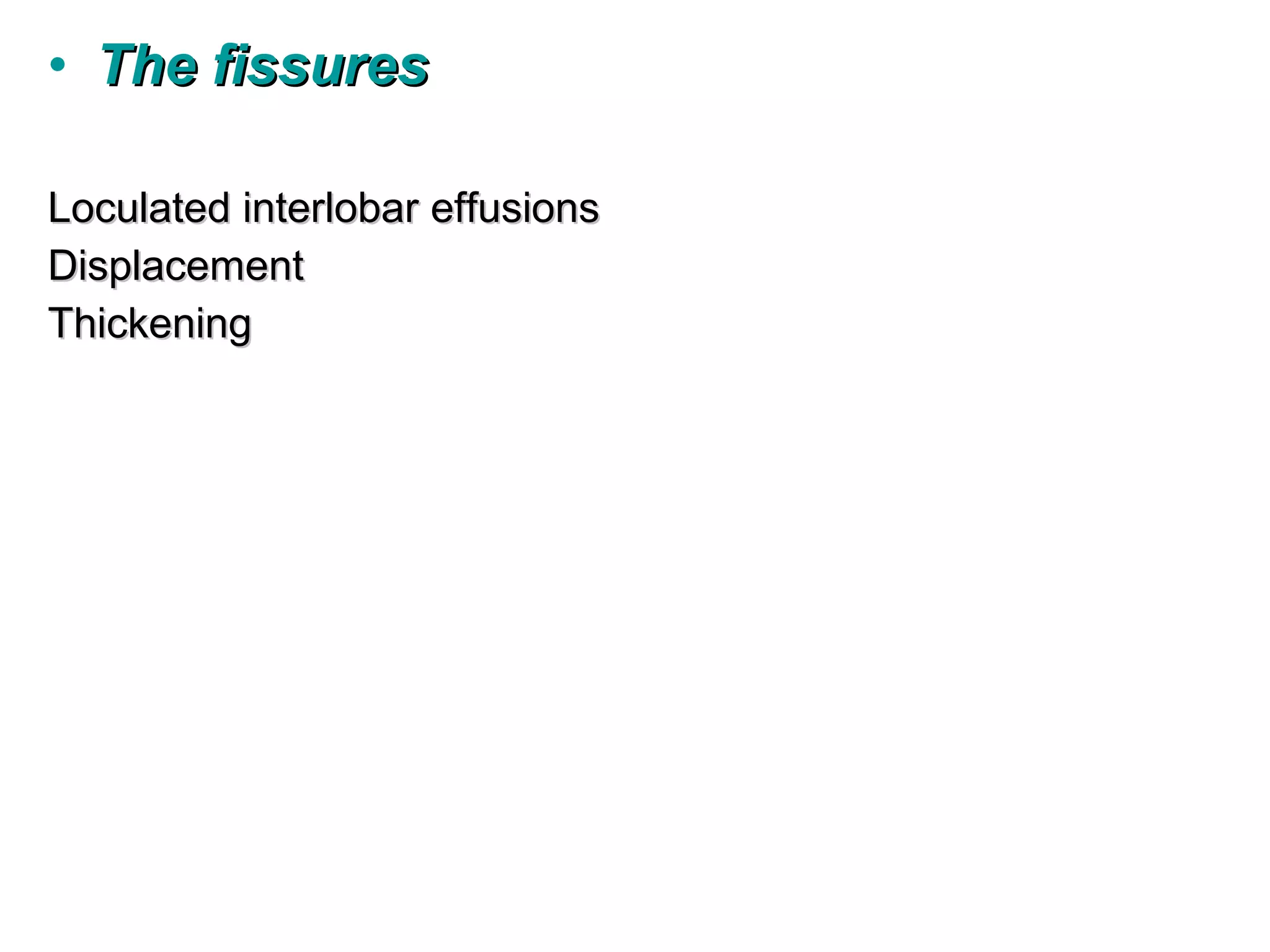 • The fissures

Loculated interlobar effusions
Displacement
Thickening
 