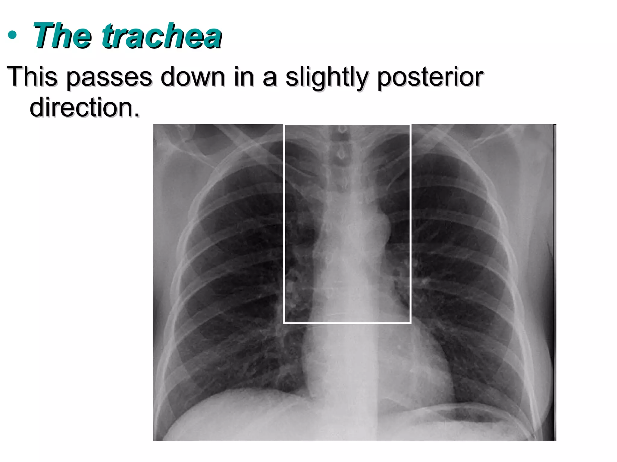 • The trachea
This passes down in a slightly posterior
 direction.
 
