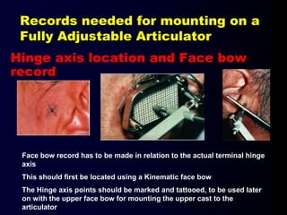 Records needed for mounting on a
Fully Adjustable Articulator
Hinge axis location and Face bow
record
Face bow record has to be made in relation to the actual terminal hinge
axis
This should first be located using a Kinematic face bow
The Hinge axis points should be marked and tattooed, to be used later
on with the upper face bow for mounting the upper cast to the
articulator
 