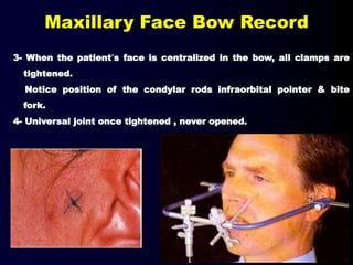 3- When the patient’s face is centralized in the bow, all clamps are
tightened.
Notice position of the condylar rods infraorbital pointer & bite
fork.
4- Universal joint once tightened , never opened.
Maxillary Face Bow Record
 