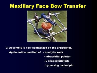 2- Assembly is now centralized on the articulator.
Again notice position of - condylar rods
- infraorbital pointer
- L shaped bitefork
bypassing incisal pin
Maxillary Face Bow Transfer
 