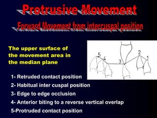 1- Retruded contact position
2- Habitual inter cuspal position
3- Edge to edge occlusion
4- Anterior biting to a reverse vertical overlap
5-Protruded contact position
The upper surface of
the movement area in
the median plane
 
