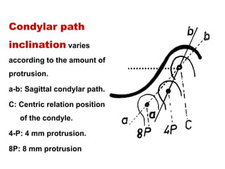 Condylar path
inclination varies
according to the amount of
protrusion.
a-b: Sagittal condylar path.
C: Centric relation position
of the condyle.
4-P: 4 mm protrusion.
8P: 8 mm protrusion
 