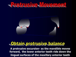 A protrusive excursion- as the mandible moves
forward, the lower anterior teeth ride down the
lingual surfaces of the maxillary anterior teeth
 