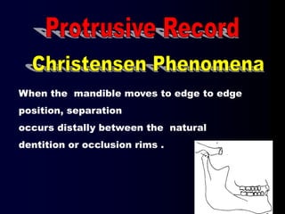 When the mandible moves to edge to edge
position, separation
occurs distally between the natural
dentition or occlusion rims .
 
