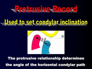 The protrusive relationship determines
the angle of the horizontal condylar path
 