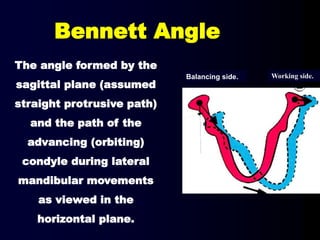 Bennett Angle
The angle formed by the
sagittal plane (assumed
straight protrusive path)
and the path of the
advancing (orbiting)
condyle during lateral
mandibular movements
as viewed in the
horizontal plane.
Balancing side. Working side.
 