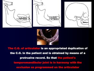 The C.G. of articulator is an appropriated duplication of
the C.G. in the patient and is obtained by means of a
protrusive record. So that the patient's
temporomandibular joint is in harmony with the
occlusion as programmed on the articulator
 