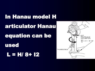 In Hanau model H
articulator Hanau
equation can be
used
L = H/ 8+ I2
 