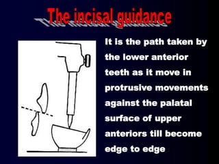 It is the path taken by
the lower anterior
teeth as it move in
protrusive movements
against the palatal
surface of upper
anteriors till become
edge to edge
 
