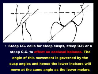 • Steep I.G. calls for steep cusps, steep O.P. or a
steep C.C. to effect an occlusal balance. The
angle of this movement is governed by the
cusp angles and hence the lower incisors will
move at the same angle as the lower molars
 
