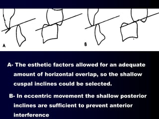 A- The esthetic factors allowed for an adequate
amount of horizontal overlap, so the shallow
cuspal inclines could be selected.
B- In eccentric movement the shallow posterior
inclines are sufficient to prevent anterior
interference
 