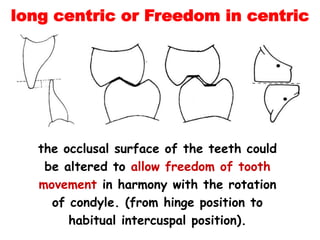 the occlusal surface of the teeth could
be altered to allow freedom of tooth
movement in harmony with the rotation
of condyle. (from hinge position to
habitual intercuspal position).
long centric or Freedom in centric
 