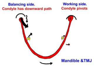 Working side.
Condyle pivots.
Balancing side.
Condyle has downward path
Mandible &TMJ
 