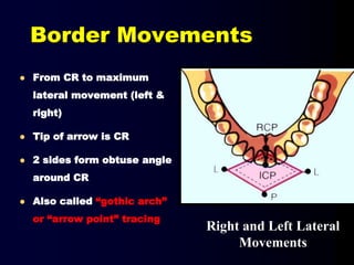 Border Movements
 From CR to maximum
lateral movement (left &
right)
 Tip of arrow is CR
 2 sides form obtuse angle
around CR
 Also called “gothic arch”
or “arrow point” tracing
Right and Left Lateral
Movements
 
