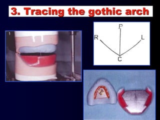 3. Tracing the gothic arch
 