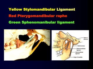 Yellow Stylomandibular Ligament
Red Pterygomandibular raphe
Green Sphenomanibular ligament
 