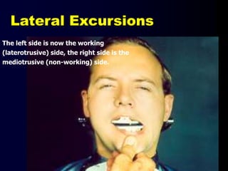 Lateral Excursions
The left side is now the working
(laterotrusive) side, the right side is the
mediotrusive (non-working) side.
 