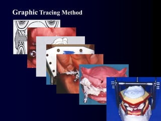 Graphic Tracing Method
 