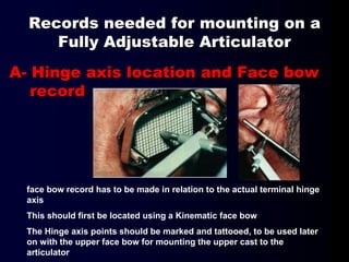 Records needed for mounting on a
Fully Adjustable Articulator
A- Hinge axis location and Face bow
record
face bow record has to be made in relation to the actual terminal hinge
axis
This should first be located using a Kinematic face bow
The Hinge axis points should be marked and tattooed, to be used later
on with the upper face bow for mounting the upper cast to the
articulator
 