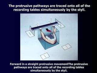 Forward in a straight protrusive movementThe protrusive
pathways are traced onto all of the recording tables
simultaneously by the styli.
The protrusive pathways are traced onto all of the
recording tables simultaneously by the styli.
 