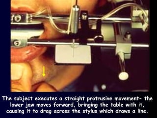 The subject executes a straight protrusive movement- the
lower jaw moves forward, bringing the table with it,
causing it to drag across the stylus which draws a line.
 