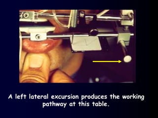 A left lateral excursion produces the working
pathway at this table.
 