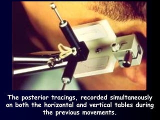 The posterior tracings, recorded simultaneously
on both the horizontal and vertical tables during
the previous movements.
 