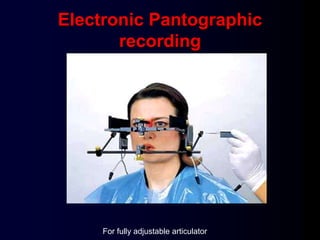 Electronic Pantographic
recording
For fully adjustable articulator
 