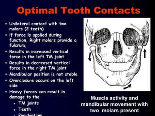 Optimal Tooth Contacts
Unilateral contact with two
molars (2 teeth)
if force is applied during
function, Right molars provide a
fulcrum,
Results in increased vertical
force in the left TM joint
Results in decreased vertical
force in the right TM joint
Mandibular position is not stable
Overclosure occurs on the left
side
Heavy forces can result in
damage to the
 TM joints
 Teeth
Muscle activity and
mandibular movement with
two molars present
 