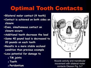 Bilateral molar contact (4 teeth)
Contact is achieved on both sides on
closure
Even, simultaneous contact on
closure occurs
Additional teeth decrease the load
Same 40 pound load is decreased to
20 pounds on each tooth
Results in a more stable occlusal
condition than previous example
Less potential for damage to
 TM joints
 Teeth
 Peridontium
Muscle activity and mandibular
movement with bilateral molar
contacts Okeson Fig. 5-7
Optimal Tooth Contacts
 