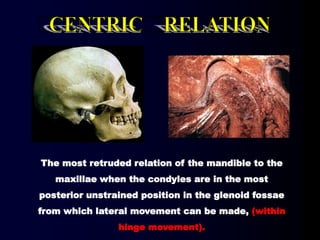 The most retruded relation of the mandible to the
maxillae when the condyles are in the most
posterior unstrained position in the glenoid fossae
from which lateral movement can be made, (within
hinge movement).
 