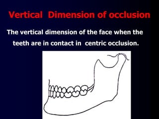 Vertical Dimension of occlusion
The vertical dimension of the face when the
teeth are in contact in centric occlusion.
 