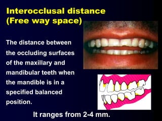 Interocclusal distance
(Free way space)
The distance between
the occluding surfaces
of the maxillary and
mandibular teeth when
the mandible is in a
specified balanced
position.
It ranges from 2-4 mm.
 