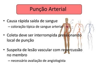 Punção Arterial
• Causa rápida saída de sangue
  – coloração típica de sangue arterial

• Coleta deve ser interrompida pressionando
  local de punção

• Suspeita de lesão vascular com repercussão
  no membro
  – necessário avaliação de angiologista
 