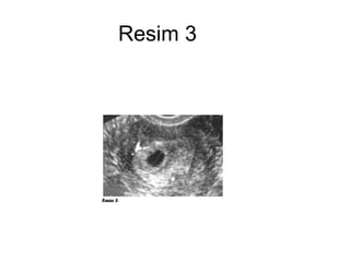 Resim 3 